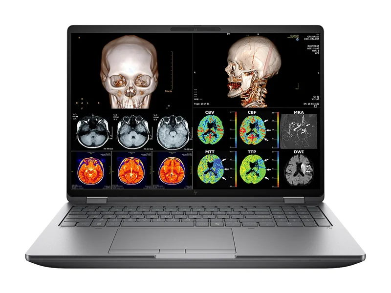 HP ZBook Fury G1i 16 Mobile Workstation | 16" DICOM Calibrated 2.5K WQXGA QHD+ 4MP (2560 x 1600) Display | Intel Core Ultra 7 265HX @ 5.3GHz MT | 20-Core | 32GB DDR5 | 512GB NVMe SSD | RTX PRO 4000 Blackwell 16GB | WiFi 7 | PerfectLUM License