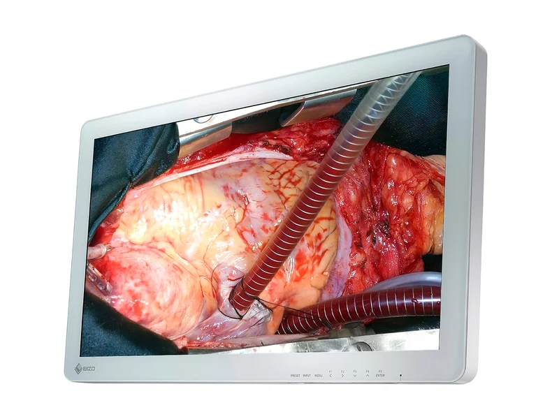 Eizo EX2620 LED 26" FHD Surgical LCD Monitor (EX2620)