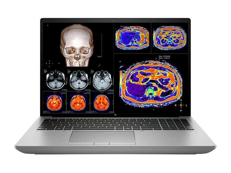HP ZBook Fury 16 G11 Mobile Radiology Workstation | 16" WUXGA DICOM Calibrated | Core i7-13850HX @ 5.30GHz | 20-Core | 32GB DDR5 | 512GB NVMe SSD | RTX 1000 Ada 6GB | WiFi 7