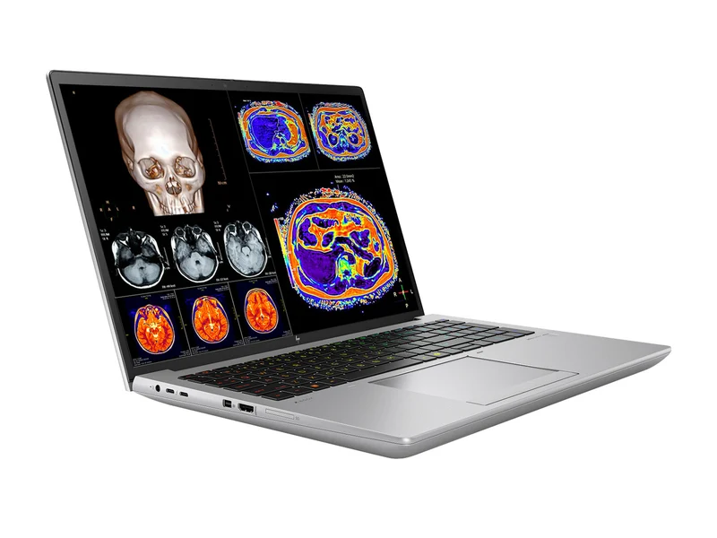 HP ZBook Fury 16 G11 Mobile Radiology Workstation | 16" WUXGA DICOM Calibrated | Core i7-13850HX @ 5.30GHz | 20-Core | 32GB DDR5 | 512GB NVMe SSD | RTX 1000 Ada 6GB | WiFi 7
