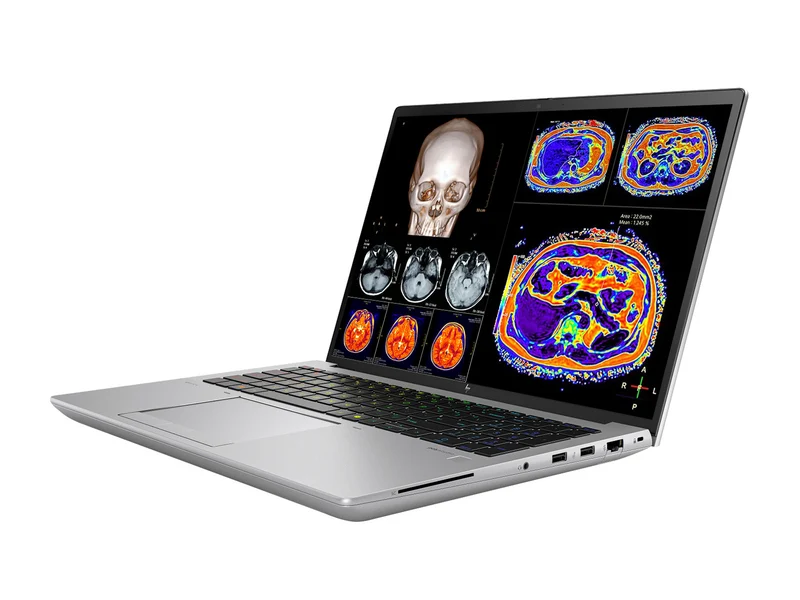 HP ZBook Fury 16 G11 Mobile Radiology Workstation | 16" WUXGA DICOM Calibrated | Core i7-13850HX @ 5.30GHz | 20-Core | 32GB DDR5 | 512GB NVMe SSD | RTX 1000 Ada 6GB | WiFi 7