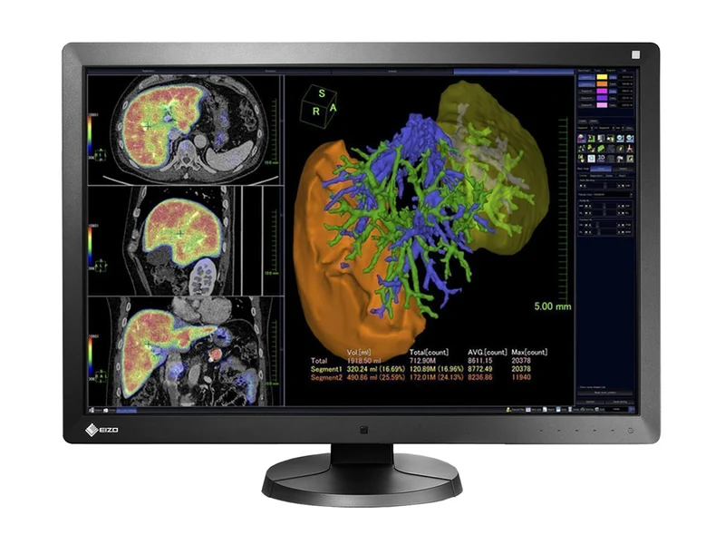 Eizo RadiForce RX650 6MP 30" Color General Radiology PACS Display (RX650)