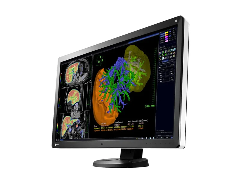 Eizo RadiForce RX650 6MP 30" Color General Radiology PACS Display (RX650)
