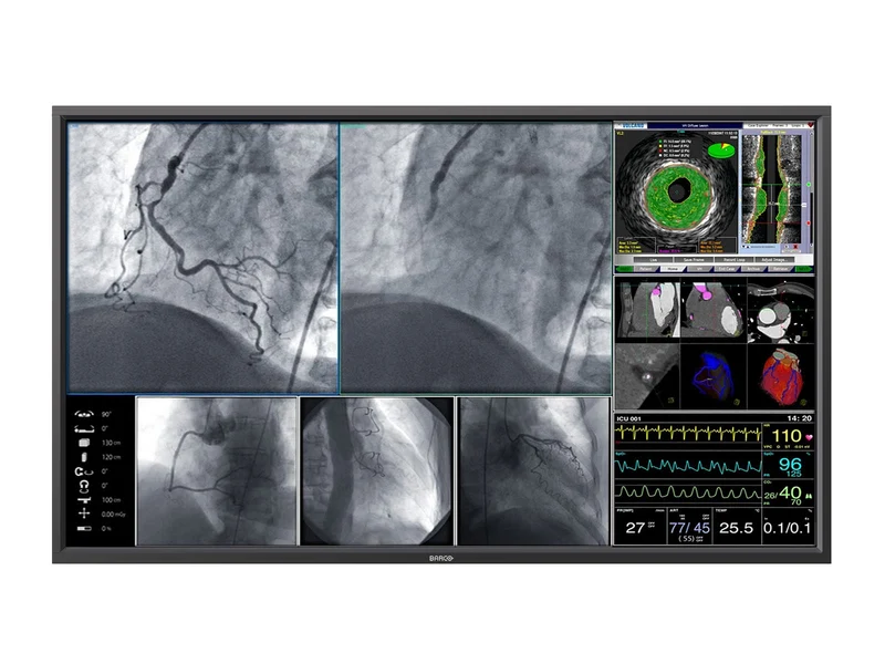 Barco Steris MDSC-8258 MNA 58" 8MP 4K Surgical Medical Display Monitor (K9307853)
