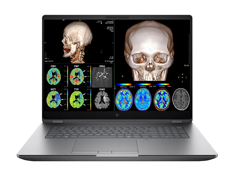 HP ZBook Fury G1i 18 Mobile Workstation | 18" DICOM Calibrated WQXGA QHD+ 4MP (2560 x 1600) Display | Intel Core Ultra 7 255HX @ 5.2GHz MT | 20-Core | 64GB DDR5 | 512GB NVMe SSD | Intel UHD Graphics | WiFi 7 | PerfectLUM License