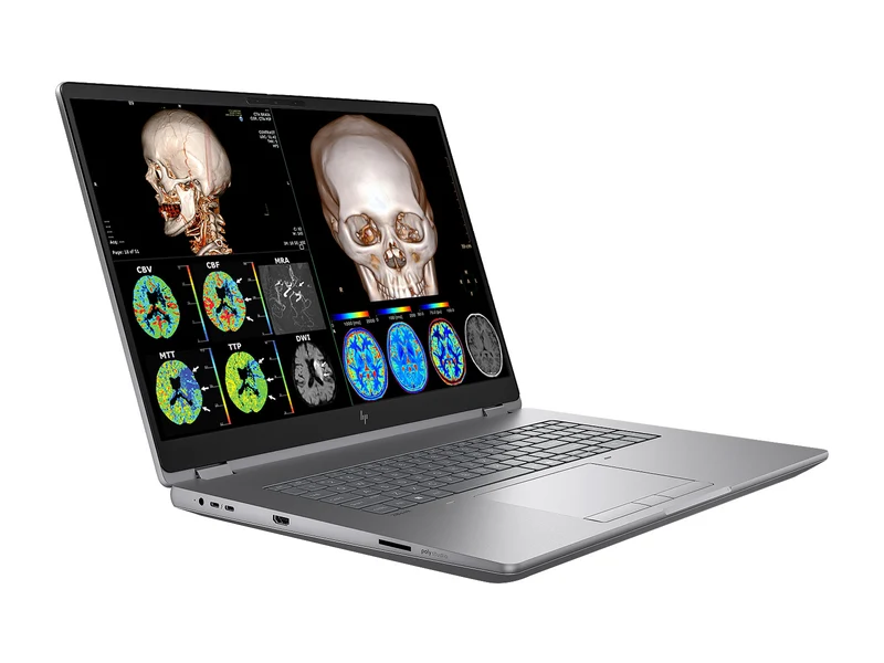 HP ZBook Fury G1i 18 Mobile Workstation | 18" DICOM Calibrated WQXGA QHD+ 4MP (2560 x 1600) Display | Intel Core Ultra 7 255HX @ 5.2GHz MT | 20-Core | 64GB DDR5 | 512GB NVMe SSD | Intel UHD Graphics | WiFi 7 | PerfectLUM License