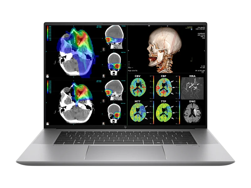 HP ZBook Studio 16 G11 Mobile Radiology Workstation | 16" 9MP 4K+ UHD DICOM Calibrated | Intel Core Ultra 7 165H @ 5.0GHz | 16-core | 128GB DDR5 | 512GB NVMe SSD | RTX 1000 Ada 6GB | WiFi 7