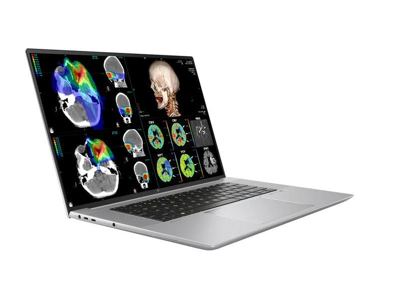 HP ZBook Studio 16 G11 Mobile Radiology Workstation | 16" 9MP 4K+ UHD DICOM Calibrated | Intel Core Ultra 7 165H @ 5.0GHz | 16-core | 128GB DDR5 | 512GB NVMe SSD | RTX 1000 Ada 6GB | WiFi 7