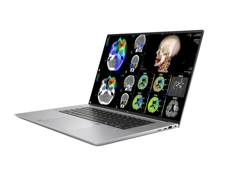 HP ZBook Studio 16 G11 Mobile Radiology Workstation | 16" 9MP 4K+ UHD DICOM Calibrated | Intel Core Ultra 7 165H @ 5.0GHz | 16-core | 128GB DDR5 | 512GB NVMe SSD | RTX 1000 Ada 6GB | WiFi 7