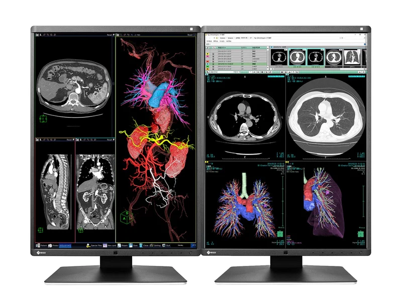 Eizo RadiForce RX350 3MP 21" Color General Radiology Diagnostic Display (RX350)