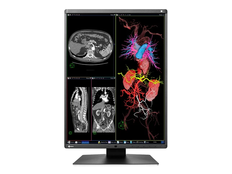 Eizo RadiForce RX350 3MP 21" Color General Radiology Diagnostic Display (RX350)