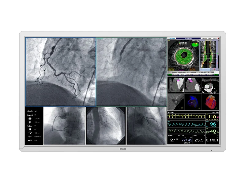 Barco MDSC-8255 LED 55" 8MP 4K Color Surgical Medical Display Monitor (K9352360)