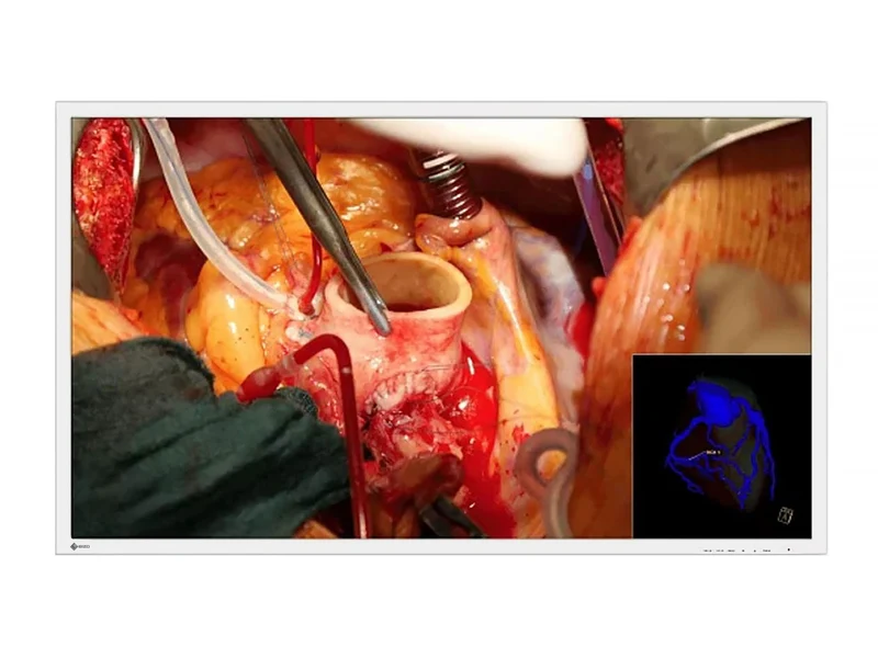 Eizo CuratOR 58" UHD 4K LED Surgical Display (EX5841)