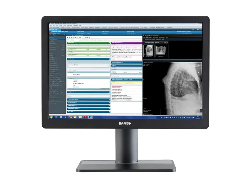 Barco Eonis MDRC-2424 SNIB 2MP 24" Clinical Review Monitor