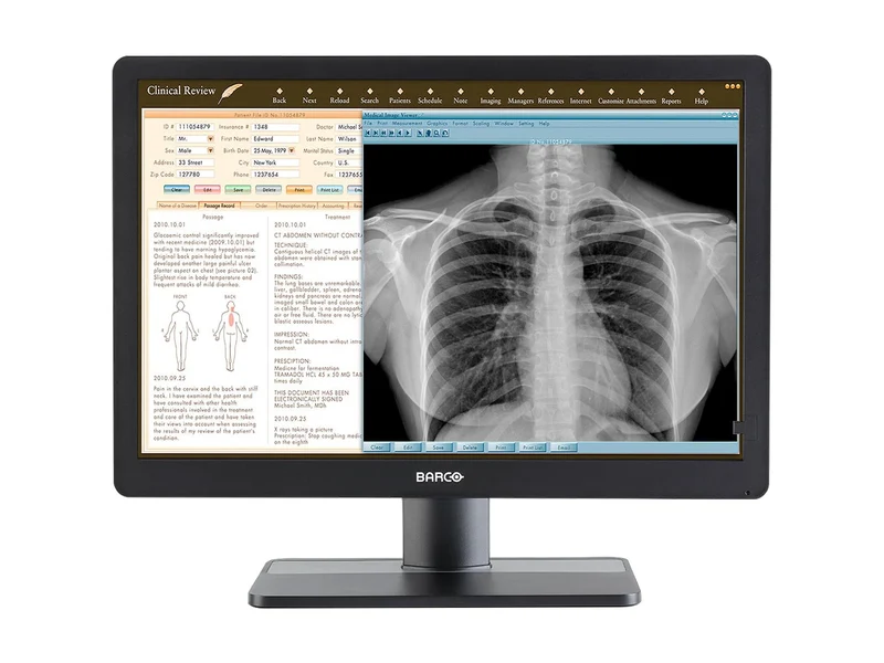Barco Eonis MDRC-2424 WUXGA 24" 2MP Color Clinical Review Display Monitor (K9610960B)
