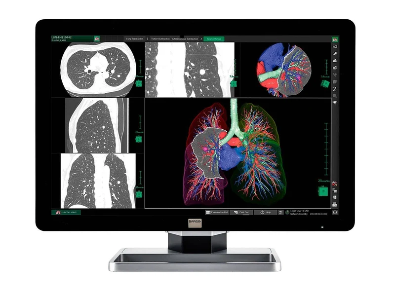 Barco Coronis Fusion MDCC-6130 6MP 30" PACS Display (includes MXRT-5550 GPU)