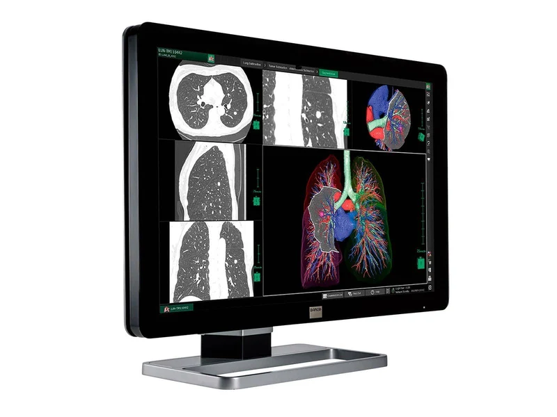 Barco Coronis Fusion MDCC-6130 6MP 30" PACS Display (includes MXRT-5550 GPU)
