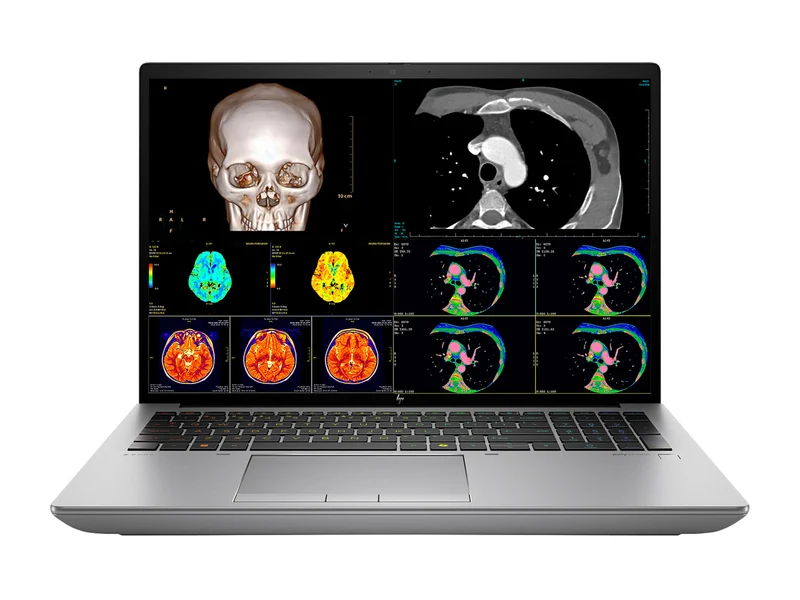 HP ZBook Fury 16 G11 Mobile Radiology Workstation | 16" OLED 9MP 4K+ UHD DICOM Calibrated | Core i9-14900HX @ 5.8GHz | 24-Core | 128GB DDR5 | 512GB NVMe SSD | RTX 1000 Ada 6GB | WiFi 7
