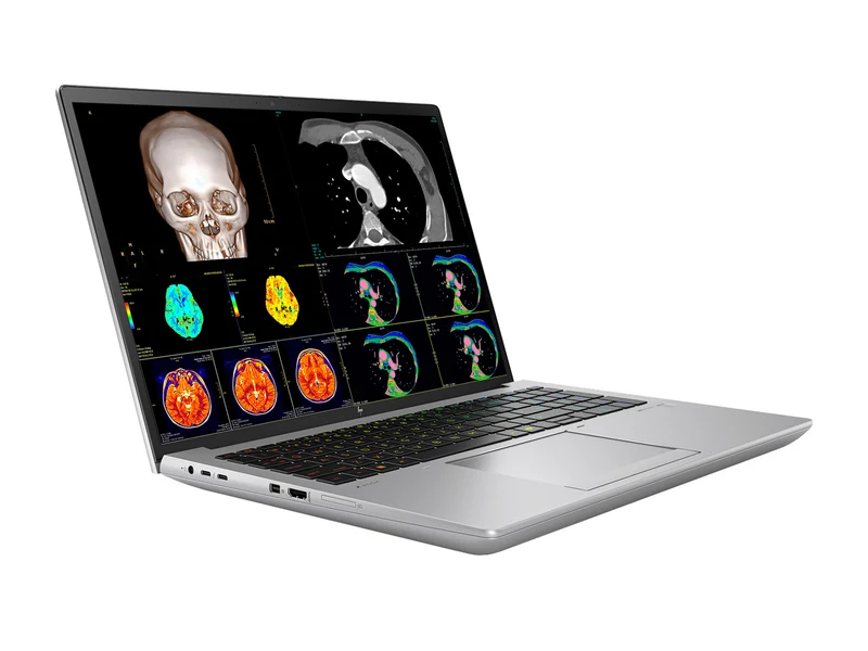 HP ZBook Fury 16 G11 Mobile Radiology Workstation | 16" OLED 9MP 4K+ UHD DICOM Calibrated | Core i9-14900HX @ 5.8GHz | 24-Core | 128GB DDR5 | 512GB NVMe SSD | RTX 1000 Ada 6GB | WiFi 7