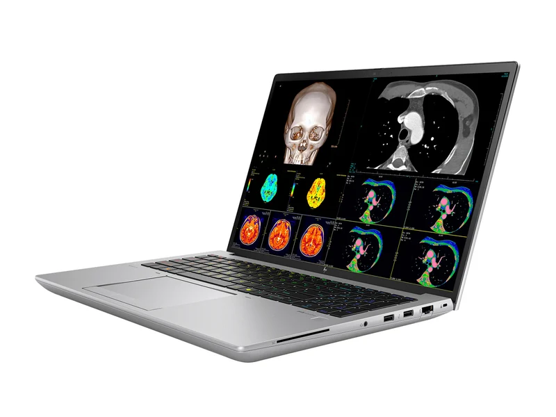 HP ZBook Fury 16 G11 Mobile Radiology Workstation | 16" OLED 9MP 4K+ UHD DICOM Calibrated | Core i9-14900HX @ 5.8GHz | 24-Core | 128GB DDR5 | 512GB NVMe SSD | RTX 1000 Ada 6GB | WiFi 7