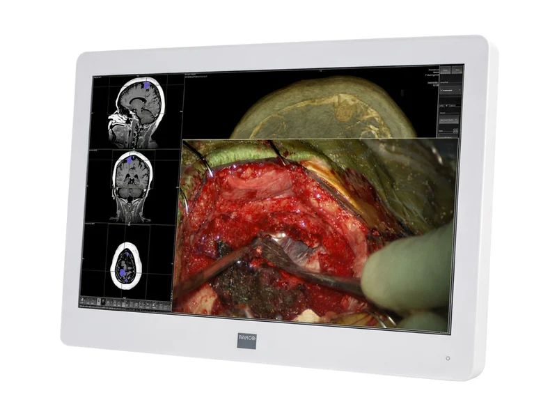 Barco MDSC-2224 MNA 24" 2MP FHD 1920 x 1200 Surgical Endoscopy Medical Display Monitor (K9307913)