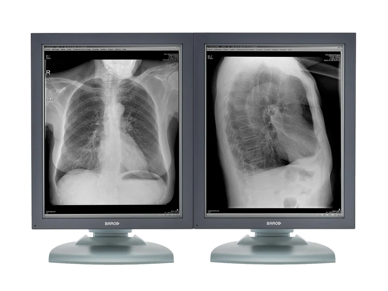 Barco Nio MDNG-2121 2MP 21" Grayscale Medical Diagnostic Radiology Monitor