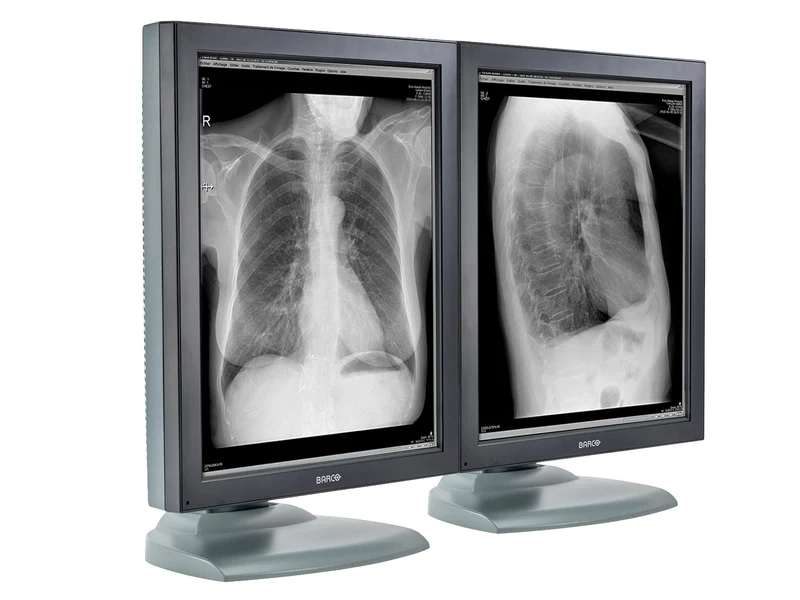 Barco Nio MDNG-2121 2MP 21" Grayscale Medical Diagnostic Radiology Monitor