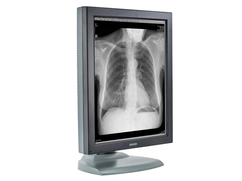 Barco Nio MDNG-2121 2MP 21" Grayscale Medical Diagnostic Radiology Monitor