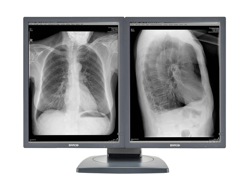 Barco Coronis MDCG-2121 2MP 21" Grayscale Diagnostic Radiology PACS Monitor