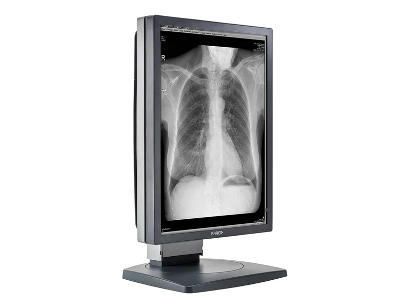 Barco Coronis MDCG-2121 2MP 21" Grayscale Diagnostic Radiology PACS Monitor