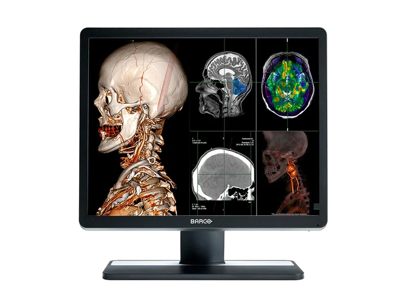 Barco Eonis MDRC-1419 SNIB 1MP 19" (1280 x 1024) 5:4 Color Clinical Review Display Monitor