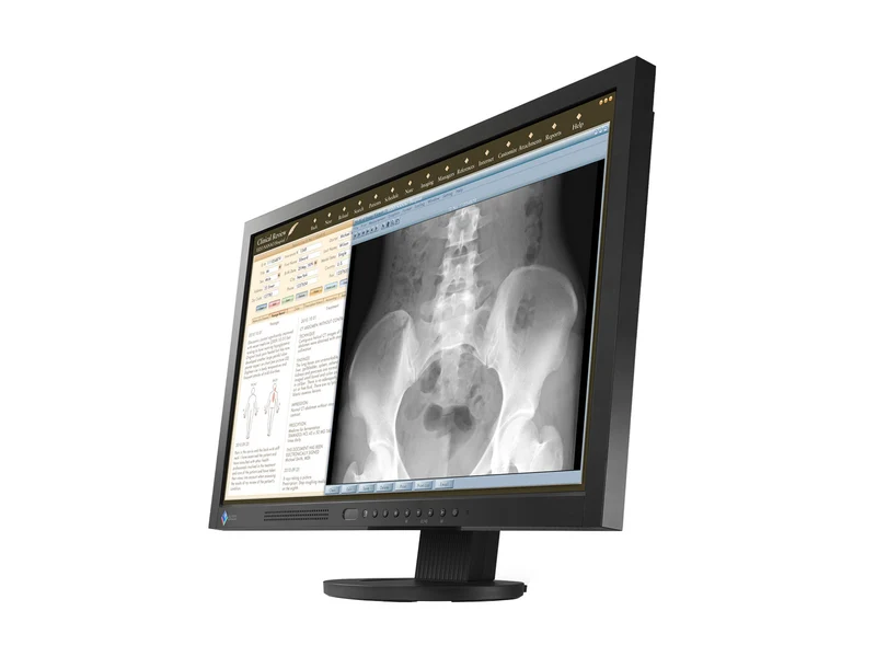 Eizo RadiForce MS230W 2MP 23" Color Clinical Review Medical Display Monitor (MS230WUKBKB)