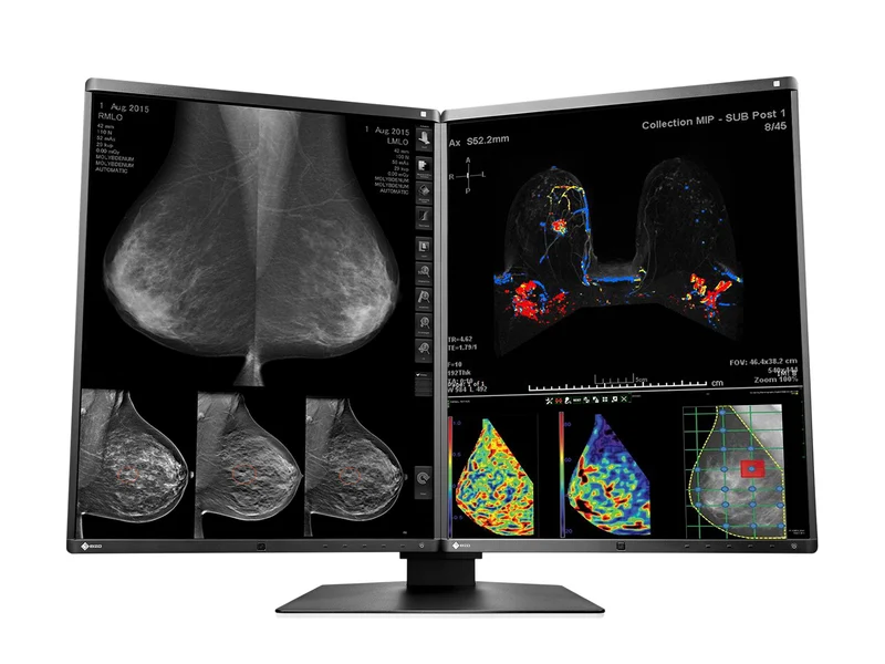 Eizo RadiForce RX570 5MP 21" Color Mammo 3D-DBT Breast Imaging Display (RX570-BK)
