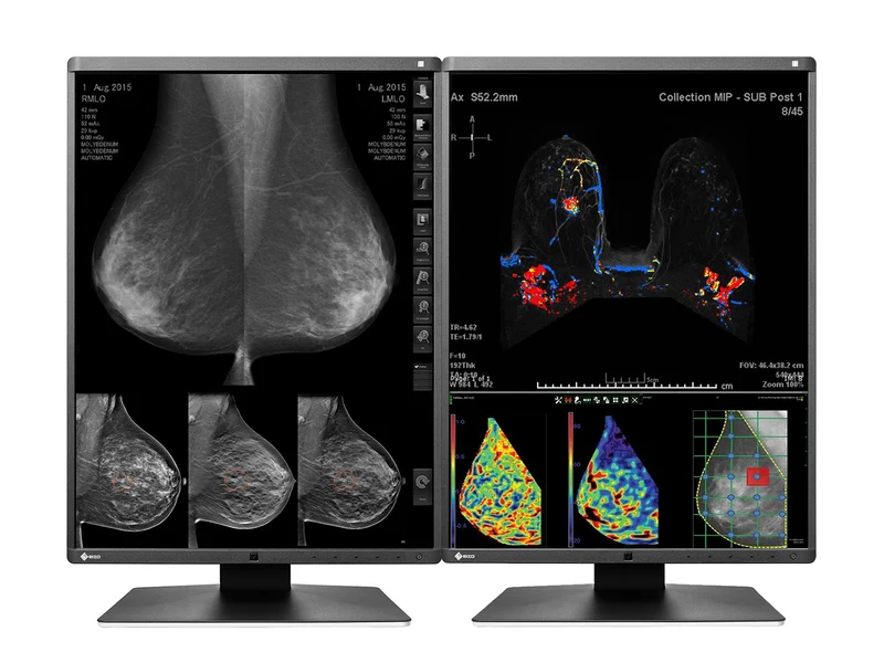 Eizo RadiForce RX570 5MP 21" Color Mammo 3D-DBT Breast Imaging Display (RX570-BK)