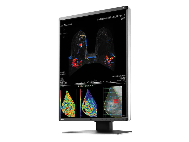 Eizo RadiForce RX570 5MP 21" Color Mammo 3D-DBT Breast Imaging Display (RX570-BK)