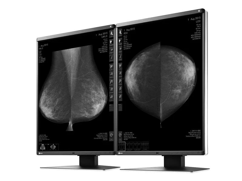 Eizo RadiForce GX550 5MP 21" Grayscale Mammo 3D-DBT Breast Imaging Display (GX550-BK)