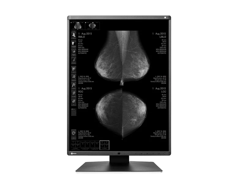 Eizo RadiForce GX550 5MP 21" Grayscale Mammo 3D-DBT Breast Imaging Display (GX550-BK)