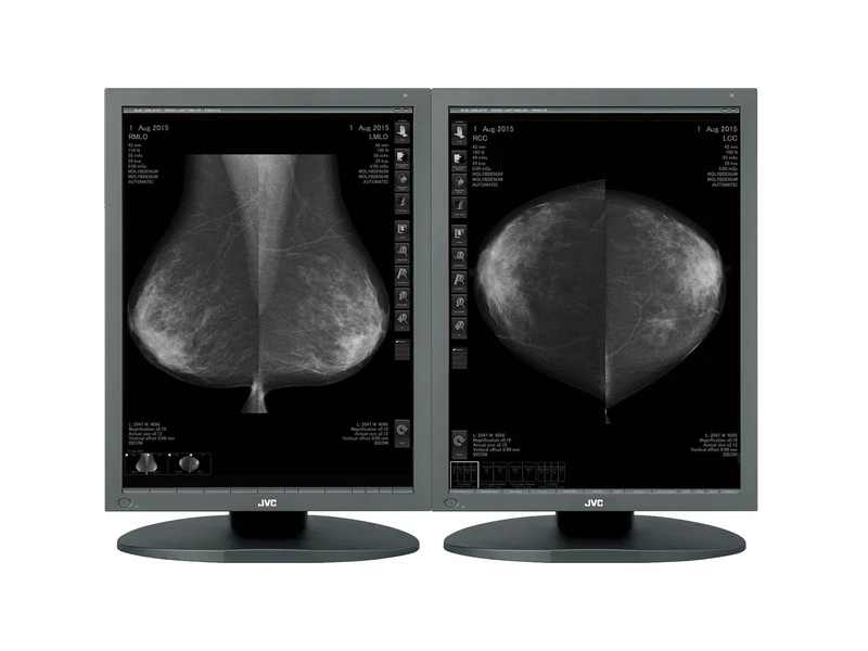 JVC Totoku MS55i2 5MP 21" Color LCD Mammo 3D-DBT Breast Imaging Display (MS55i2)