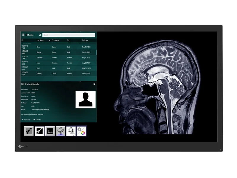 Eizo CuratOR LX2420-T 24" Surgical Touchscreen Monitor (LX2420-T)