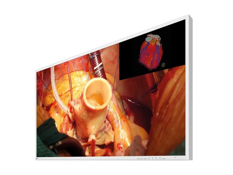 Eizo 43" 4K UHD Surgical Endoscopy Medical Display Monitor (EX4342)