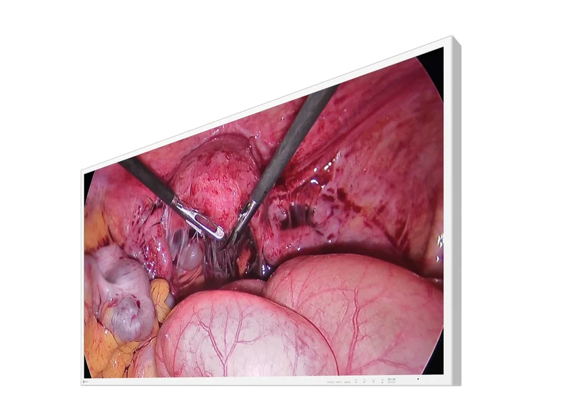 Eizo 43" 4K 3D UHD Surgical Endoscopy Medical Display Monitor (EX4342-3D)