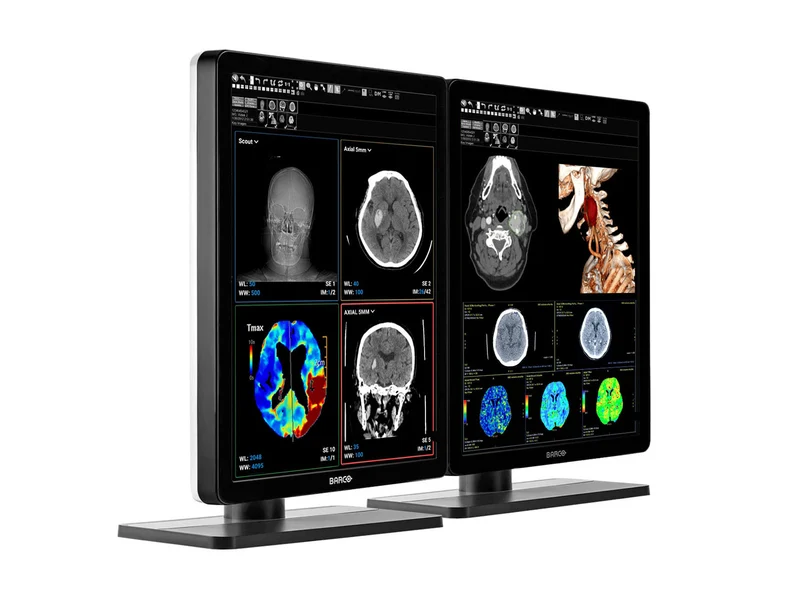 Pair (x2) Barco Nio MDNC-3421 3MP with 21" Color General Radiology Monitors with MXRT-6700
