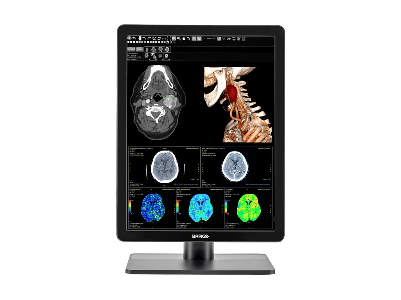 Pair (x2) Barco Nio MDNC-3421 3MP with 21" Color General Radiology Monitors with MXRT-6700