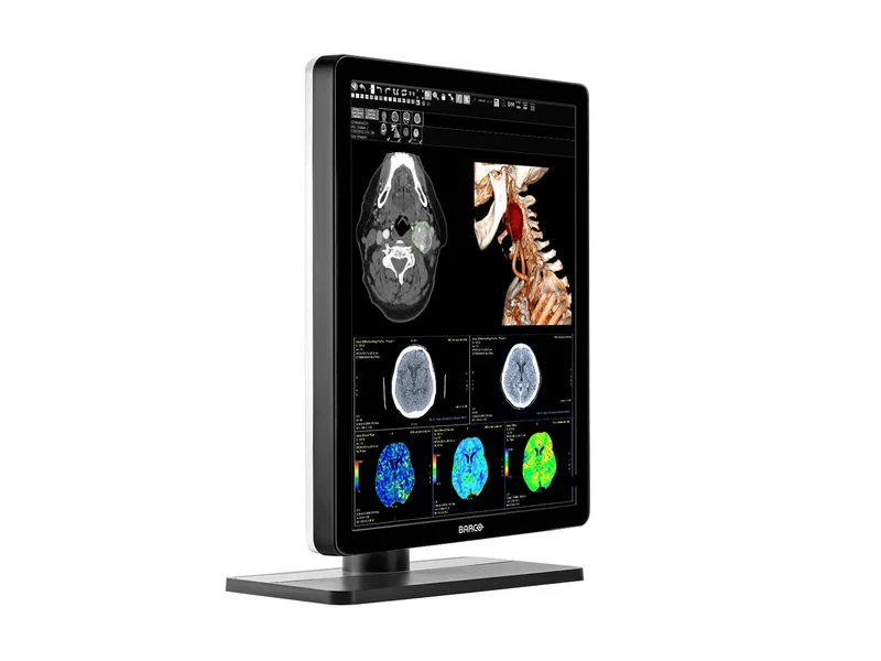 Pair (x2) Barco Nio MDNC-3421 3MP with 21" Color General Radiology Monitors with MXRT-6700