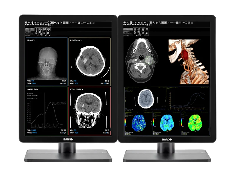 Pair (x2) Barco Nio MDNC-3421 3MP with 21" Color General Radiology Monitors with MXRT-6700