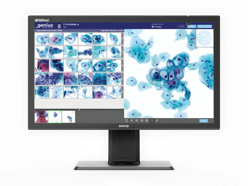 Barco Hologic MDPC‑8127 HLX Genius Review Station 8MP 27" Color Medical Display for Digital Pathology (CMP01669)