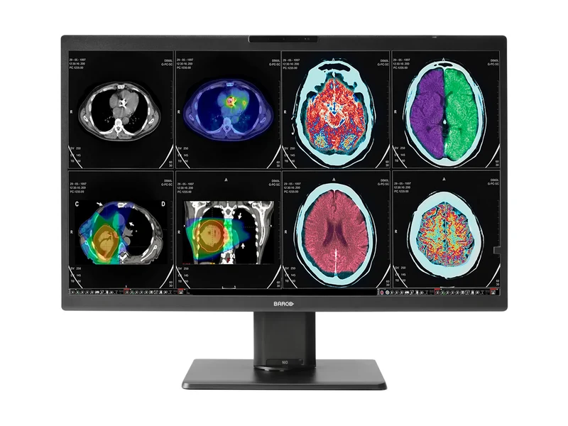 Barco Nio Color 8MP MDNC-8132 32-Inch Diagnostic Radiology Monitor, 3840 x 2160, DICOM Calibrated 500 cd/m², 850 cd/m² Max, 1350:1 Contrast, Self-Calibrating I-Guard, QAWeb Enterprise, USB-C Docking, PACS Display for CT, MRI, X-Ray & Ultrasound