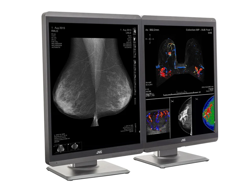 Pair (x2) JVC Totoku CL-S500 5MP 21" Color Mammo 3D-DBT Breast Imaging Display (CL-S500)