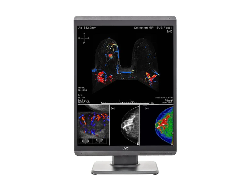 Pair (x2) JVC Totoku CL-S500 5MP 21" Color Mammo 3D-DBT Breast Imaging Display (CL-S500)