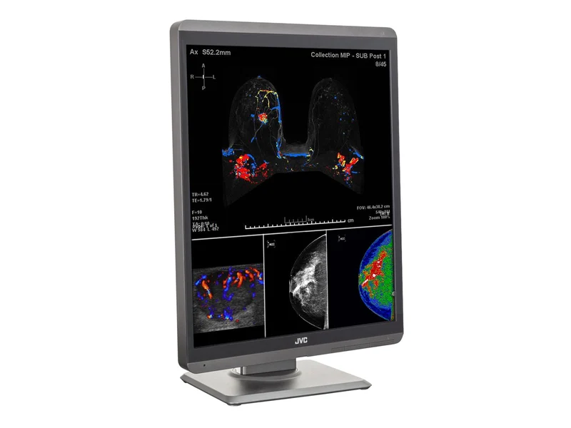 Pair (x2) JVC Totoku CL-S500 5MP 21" Color Mammo 3D-DBT Breast Imaging Display (CL-S500)